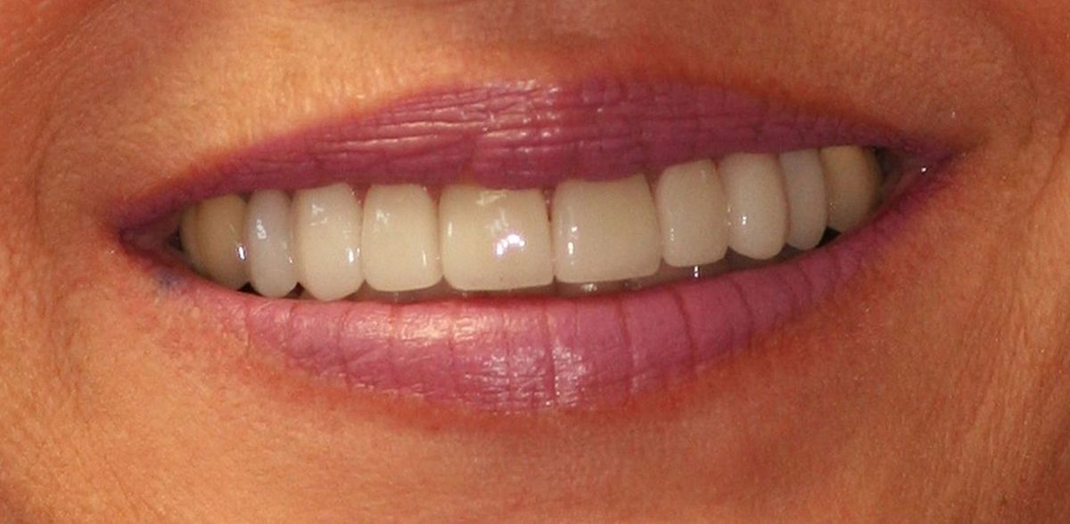 Gallery Country Club Dental Care